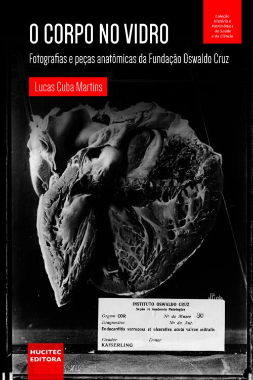 O corpo no vidro: fotografias e peças anatômicas da Fundação Oswaldo Cruz | Lucas Cuba Martins